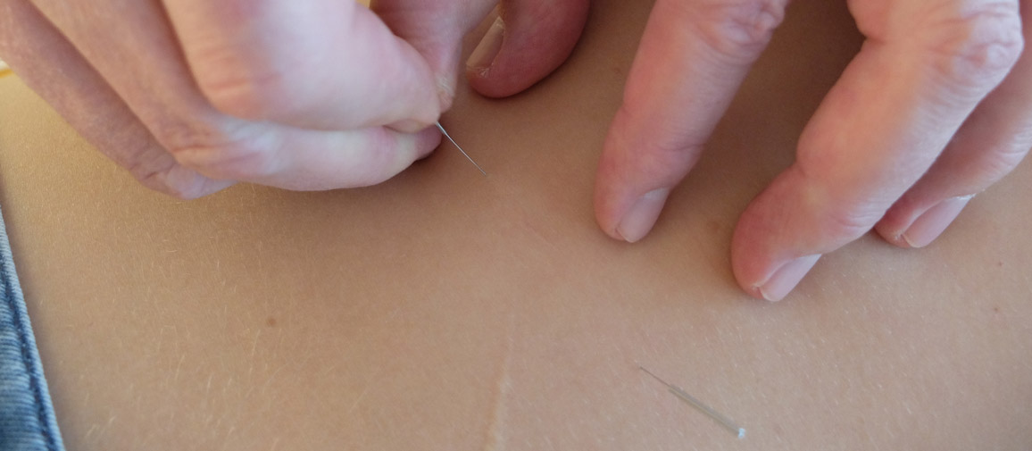 Dynamic Content Image